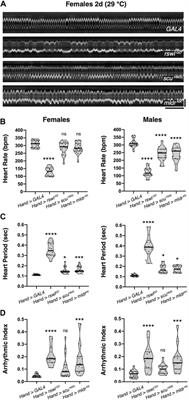 Reduction of Drosophila Mitochondrial RNase P in Skeletal and Heart Muscle Causes Muscle Degeneration, Cardiomyopathy, and Heart Arrhythmia